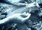 inserting needle into hand